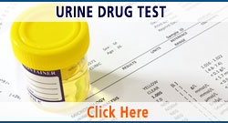 urine durg test